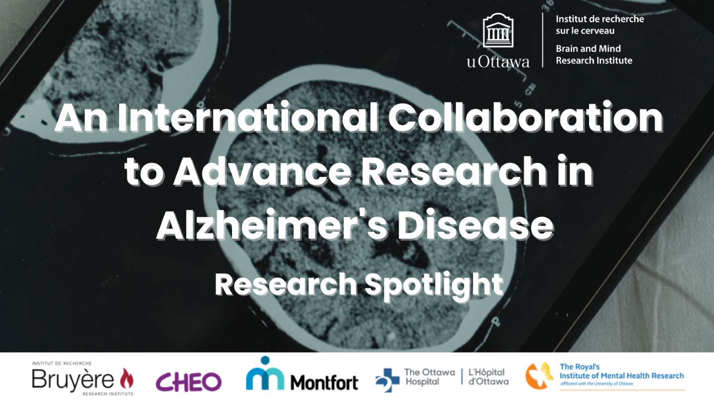 Image of a brain scan as the background with text that reads "An International Collaboration to Advance Research In Alzheimer's Disease. Research Spotlight". With the uOBMRI logo and sponsors at the bottom